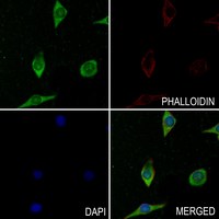 3 - Anti-Alpha-tubulin (Phospho-Y272) Antibody AP54060