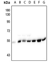 1 - Anti-Alpha-tubulin (Phospho-Y272) Antibody AP54060