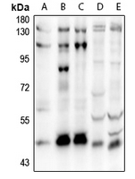 1 - Anti-SOX8 Antibody AP54062