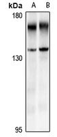 1 - Anti-EVI1 Antibody AP54063
