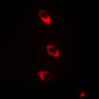 3 - Anti-CaMK2 beta Antibody AP54064