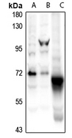 1 - Anti-CaMK2 beta Antibody AP54064
