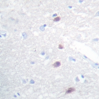 19 - Anti-FOXB1/2 Antibody AP54065