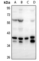 1 - Anti-FOXB1/2 Antibody AP54065