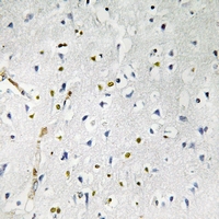 19 - Anti-RhoBTB1 Antibody AP54066