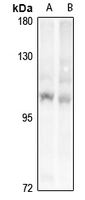 1 - Anti-PRKD1/2/3 Antibody AP54067