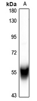 1 - Anti-Cytochrome P450 2C8/9/18/19 Antibody AP54068
