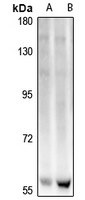 1 - Anti-ELOA3 Antibody AP54069