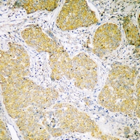 19 - Anti-CCDC109A Antibody AP54071