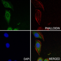 3 - Anti-CCS Antibody AP54072