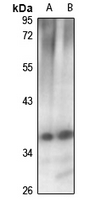 1 - Anti-CCS Antibody AP54072