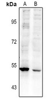 1 - Anti-RASGEF1A Antibody AP54077