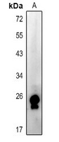 1 - Anti-RAB15 Antibody AP54078