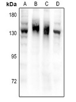 1 - Anti-NPR2 Antibody AP54082