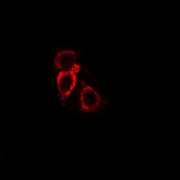 3 - Anti-MCH Receptor 1 Antibody AP54085