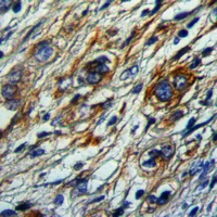 19 - Anti-MCH Receptor 1 Antibody AP54085