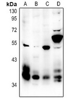 1 - Anti-MCH Receptor 1 Antibody AP54085
