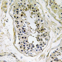 19 - Anti-pro-BMP8 Antibody AP54086