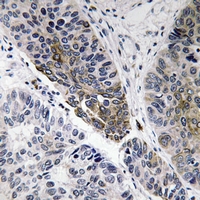 19 - Anti-IgA1/2 Antibody AP54087