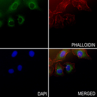 3 - Anti-Semaphorin 3C Antibody AP54088