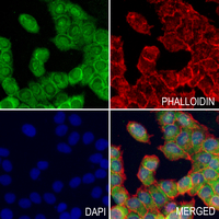 3 - Anti-Actin-pan (Acetyl-K52/50/51) Antibody AP54090