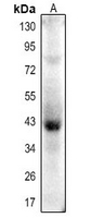 1 - Anti-Actin-pan (Acetyl-K52/50/51) Antibody AP54090