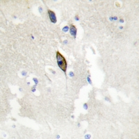 19 - Anti-EPHB1/2/3 Antibody AP54091