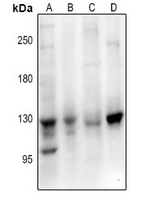 1 - Anti-EPHB1/2/3 Antibody AP54091