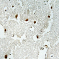 19 - Anti-TRERF1 Antibody AP54094