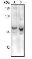 1 - Anti-HPC2 Antibody AP54095