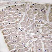 19 - Anti-Collagen 16 alpha 1 Antibody AP54096