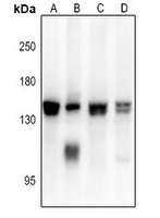 1 - Anti-ADAMTS16 Antibody AP54098