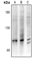 1 - Anti-CCP3 Antibody AP54100