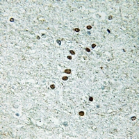 19 - Anti-REXO1 Antibody AP54102