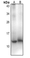 1 - Anti-CCL18 Antibody AP54103