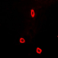 3 - Anti-SCN7A Antibody AP54104