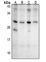 1 - Anti-NKX2-8 Antibody AP54106