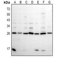 1 - Anti-BCL7A Antibody AP54107
