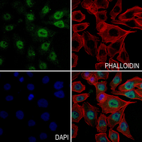3 - Anti-Histone H2A (Acetyl-K7) Antibody AP54109
