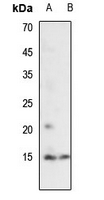 1 - Anti-Histone H2A (Acetyl-K7) Antibody AP54109