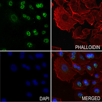 3 - Anti-Histone H2B (Acetyl-K34) Antibody AP54110