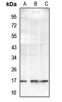 1 - Anti-Histone H2B (Acetyl-K34) Antibody AP54110
