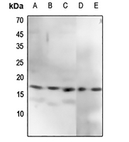 1 - Anti-CENPA (Phospho-S7) Antibody AP54111
