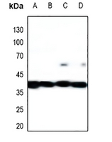1 - Anti-MKK1/2 Antibody AP54112