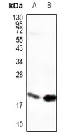 1 - Anti-PDE6G Antibody AP54113