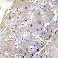 19 - Anti-TNFAIP2 Antibody AP54114