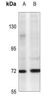1 - Anti-TNFAIP2 Antibody AP54114
