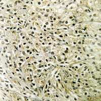 19 - Anti-DLC1 Antibody AP54115