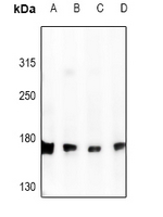 1 - Anti-DLC1 Antibody AP54115