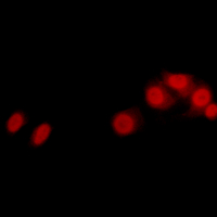 3 - Anti-LATS2 Antibody AP54116